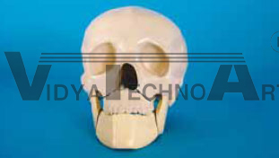 Skull, with holder, fractured, mandible